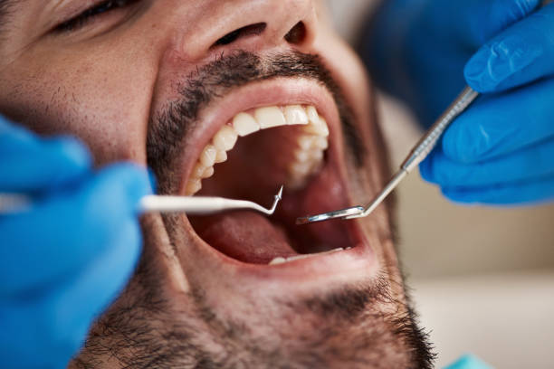 Best Mobile Emergency Dentist in Bellevue, IL