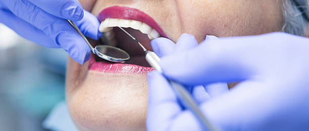 Best Emergency Dental Services for Seniors in Bellevue, IL