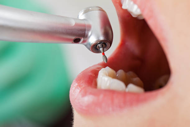 Best Weekend Emergency Dentist in Bellevue, IL